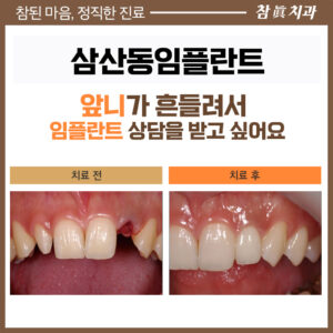 삼산동임플란트