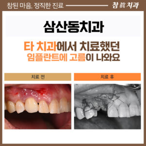 삼산동치과