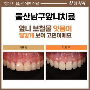 울산삼산동치과