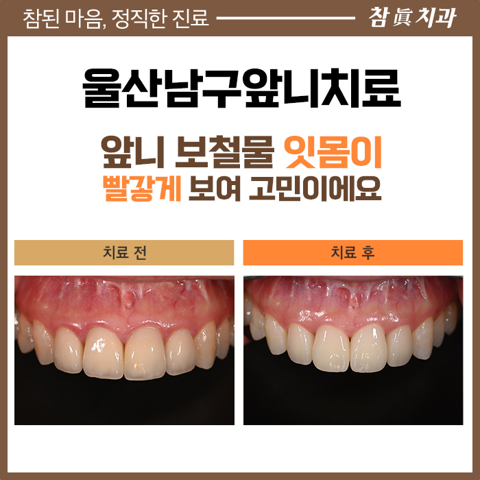 울산삼산동치과