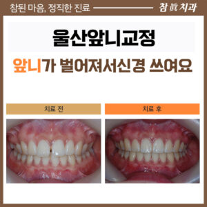 참치과