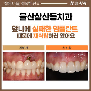울산삼산동치과
