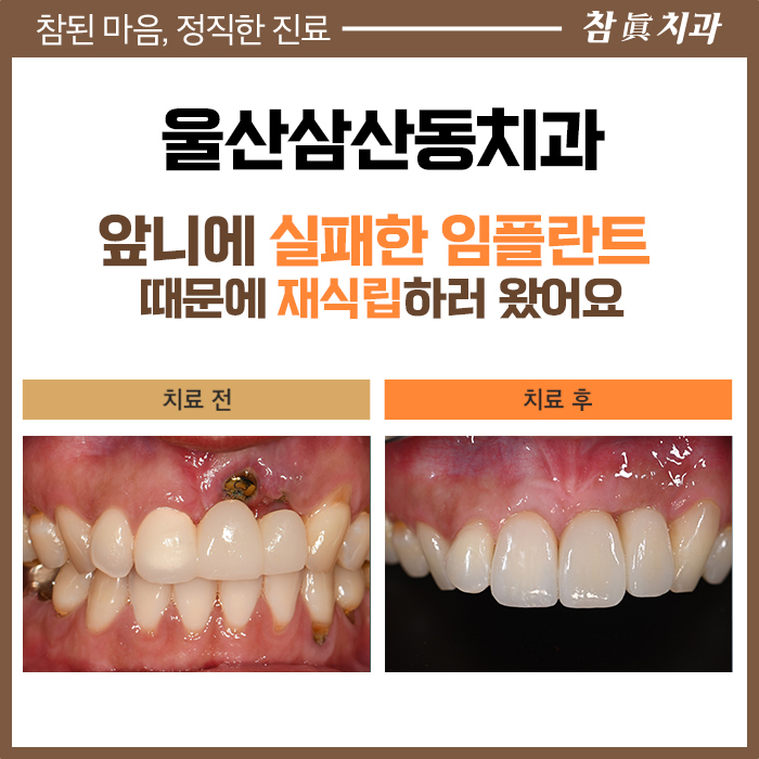 울산삼산동치과 