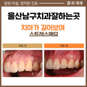 울산삼산동치과