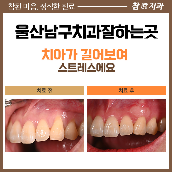 울산삼산동치과