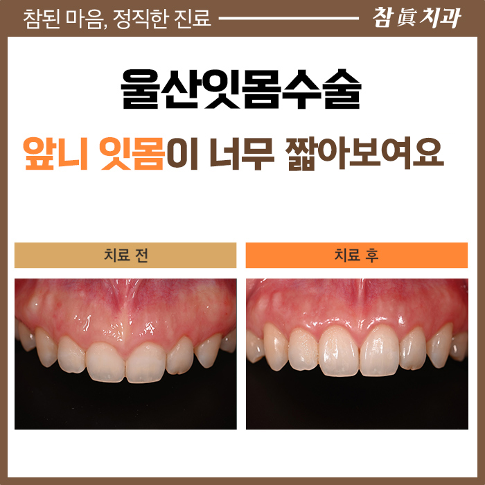 울산삼산동치과
