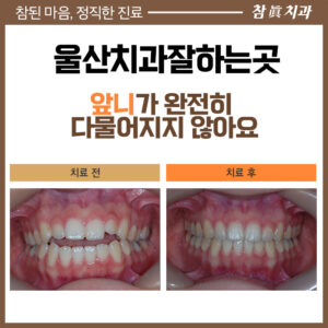 울산삼산동치과