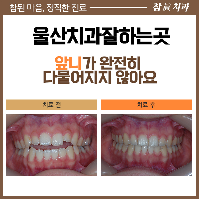 울산삼산동치과 