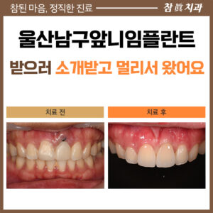 울산남구임플란트