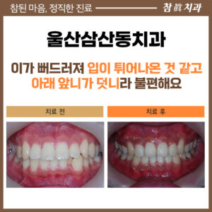 울산삼산동치과
