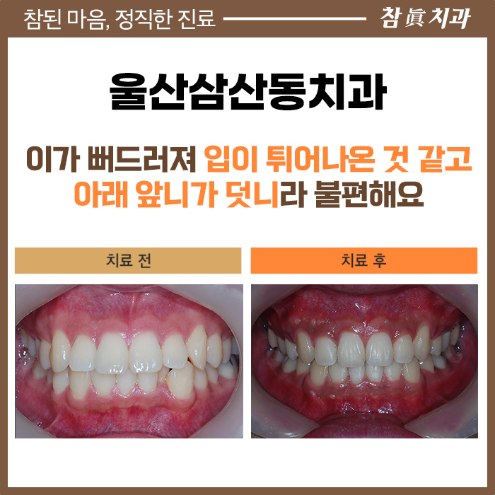 울산삼산동치과 