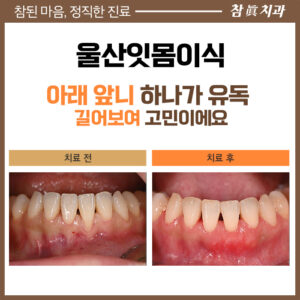 울산삼산동치과