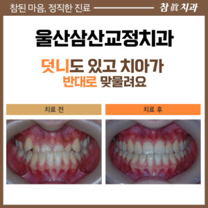 울산치과