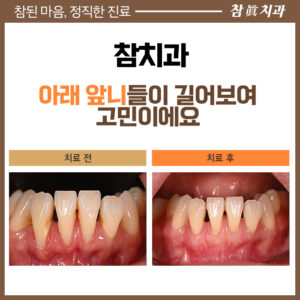 참치과