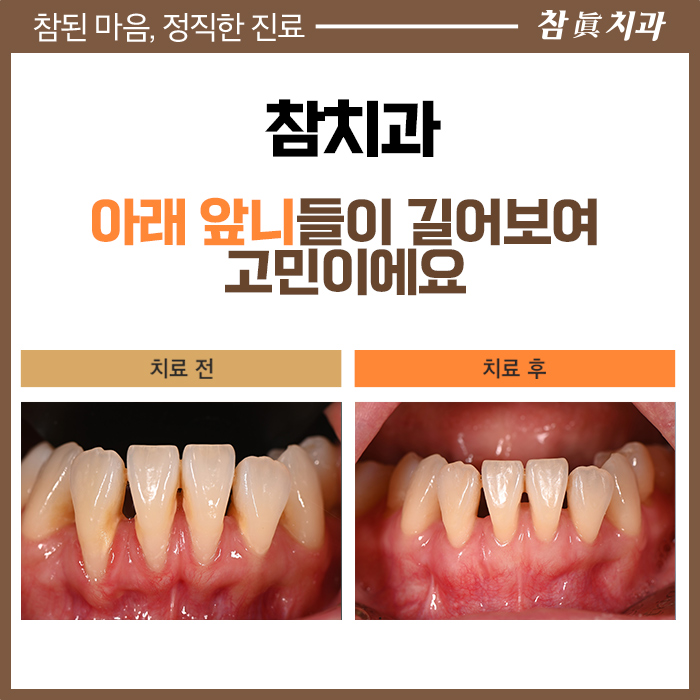 참치과