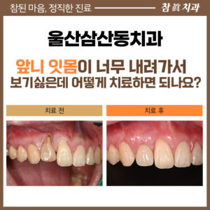 울산삼산동치과