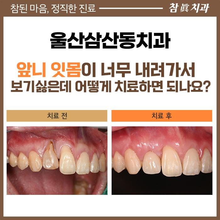 울산삼산동치과 