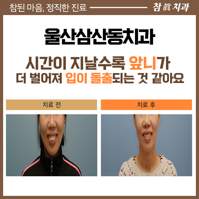 울산삼산동치과 