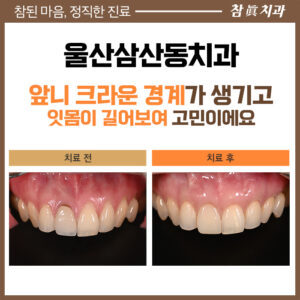 울산삼산동치과