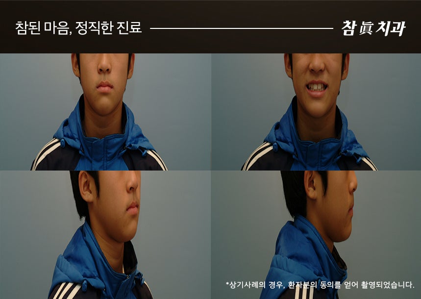 참치과