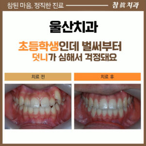 참치과