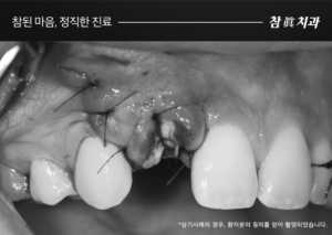 울산삼산동치과