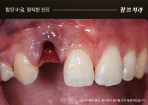 울산삼산동치과