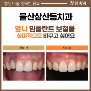 울산삼산동치과