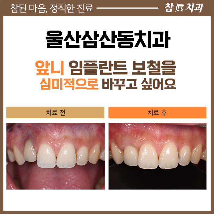 울산삼산동치과