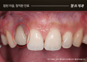 울산삼산동치과