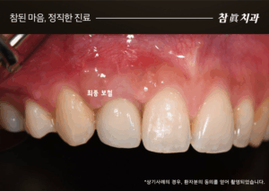 울산삼산동치과