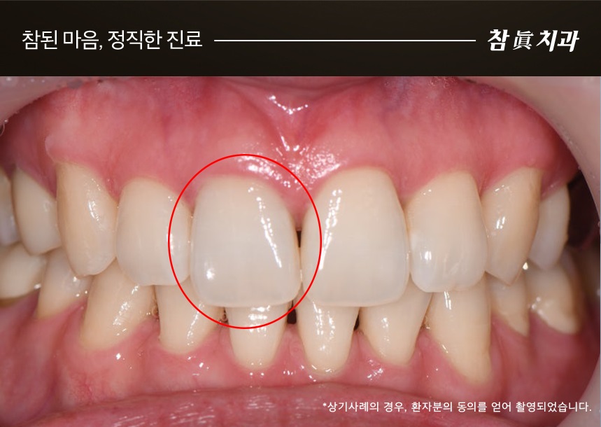 참치과