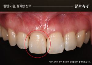 참치과