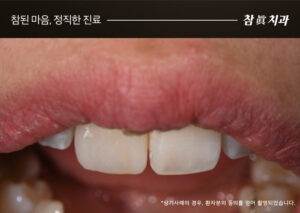 참치과