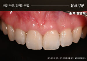 참치과