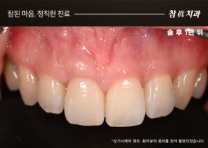 참치과