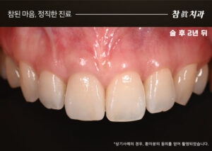 참치과