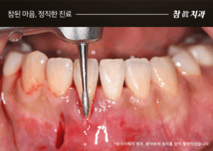 울산삼산동치과
