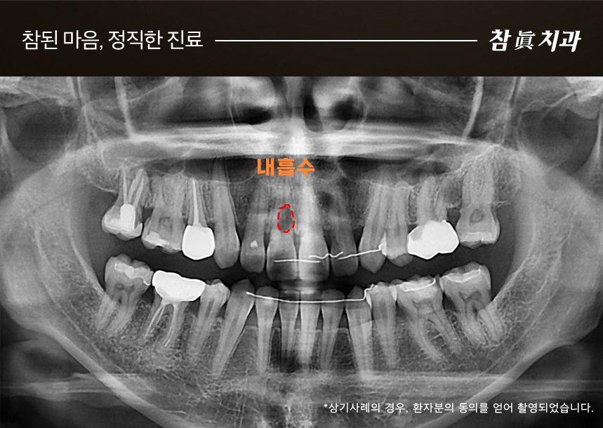 참치과