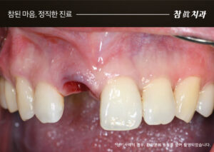 참치과