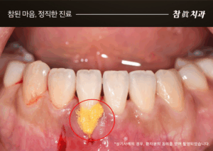 울산삼산동치과