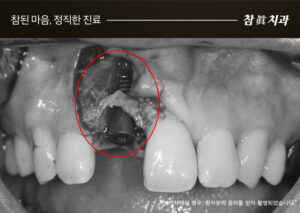 참치과