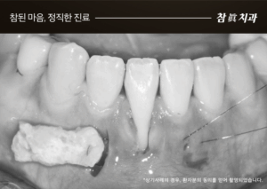 울산삼산동치과