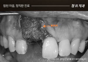 참치과