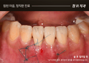 울산삼산동치과