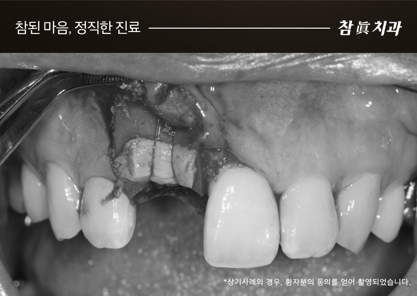 참치과
