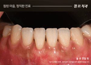 울산삼산동치과
