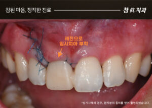 참치과
