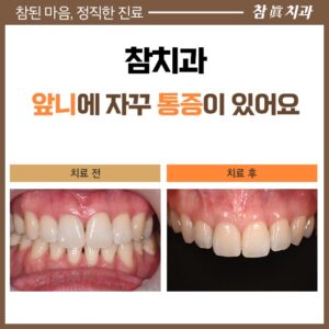 참치과