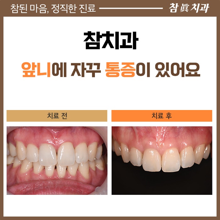 참치과